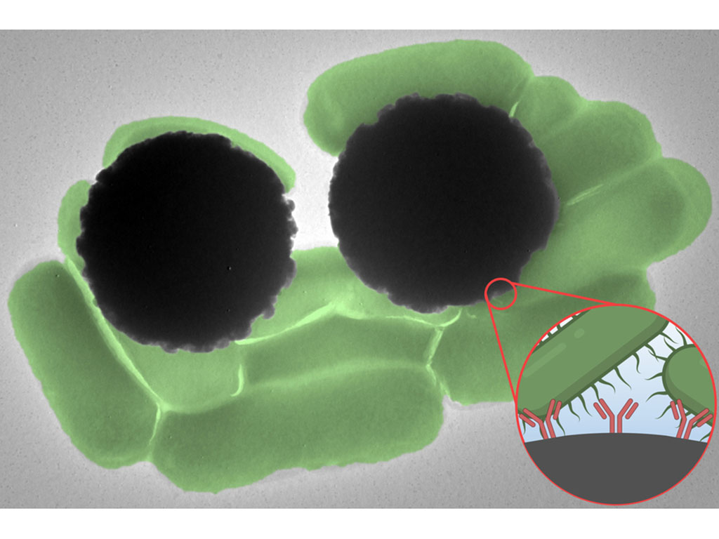 TEM image shows about 10 pill-shaped green Salmonella bacterium and 2 large Dynabeads as grey spheres. An inset shows the hairy Salmonella interacting with the Y-shaped antibodies on the Dynabeads.