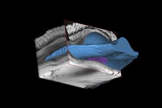 Soft robotics breakthrough manages immune response for implanted devices