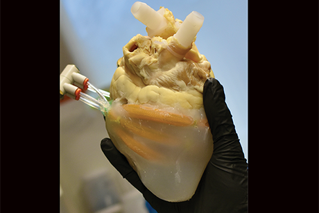 Evaluation of surgical techniques for Tetralogy of Fallot, a congenital heart defect